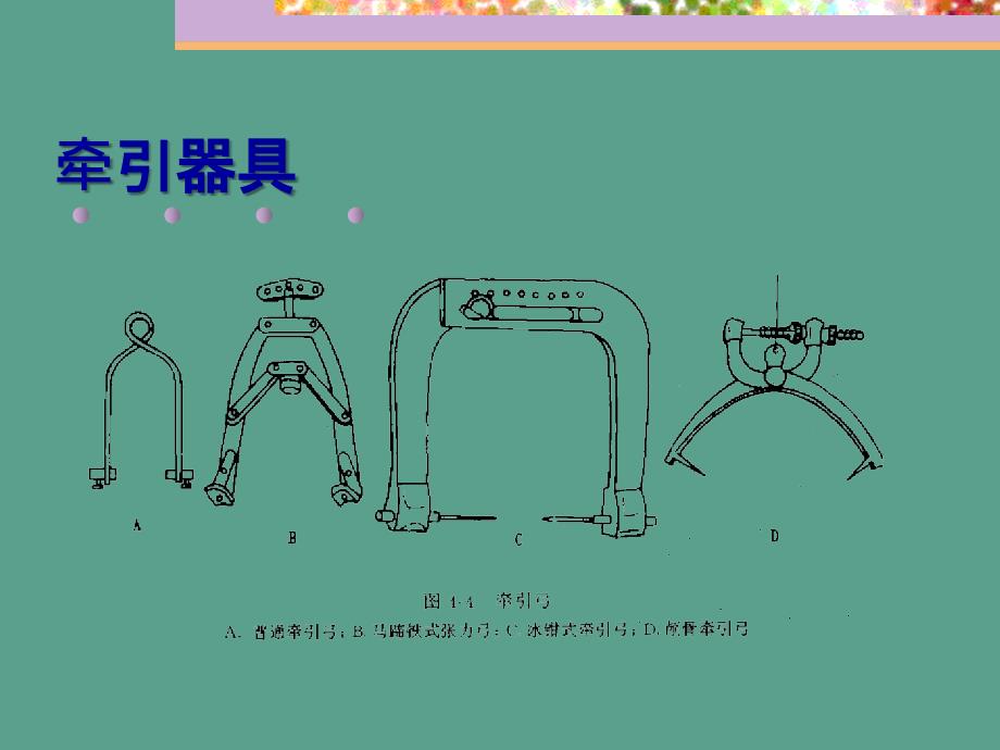 牵引疗法分析ppt课件_第4页