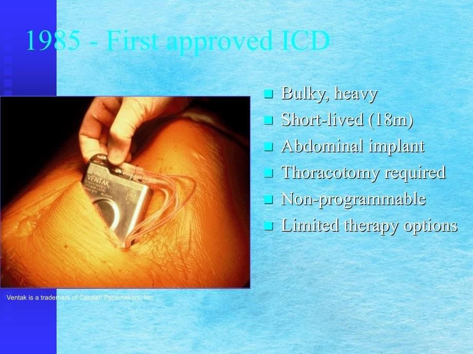 除颤起搏器的临床应用ppt课件_第5页