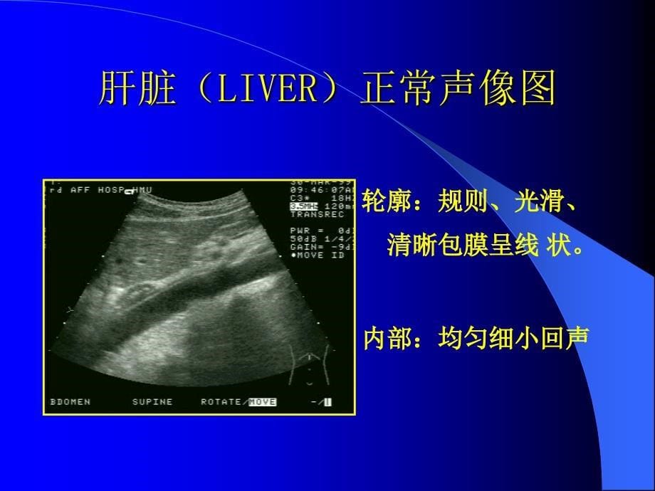 《超声影像诊断学》教学课件-肝、胆道、胰腺的超声诊断_第5页