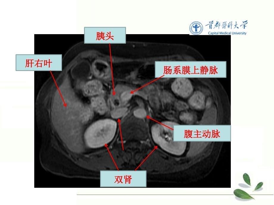 腹部断层解剖学 第五节腹部横断层解剖_第5页