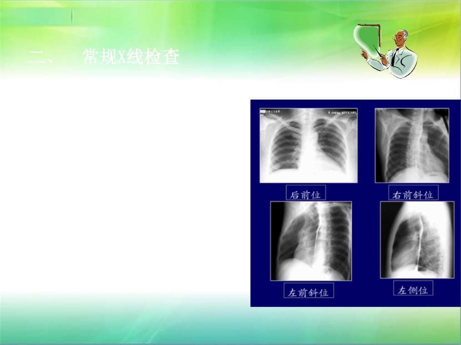 心脏检查的各种设备_第5页