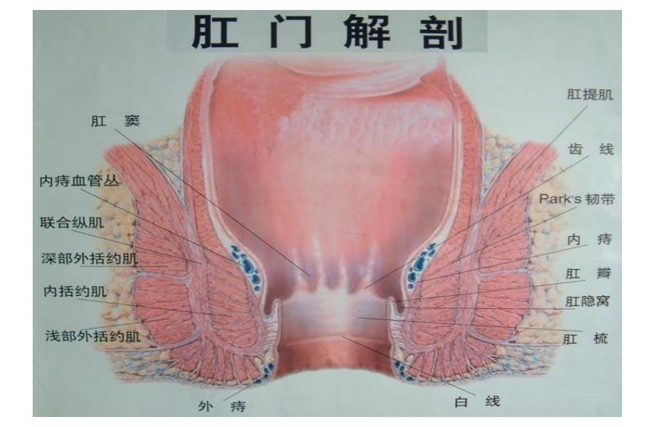 痔疮术进展及术前后护理_第3页