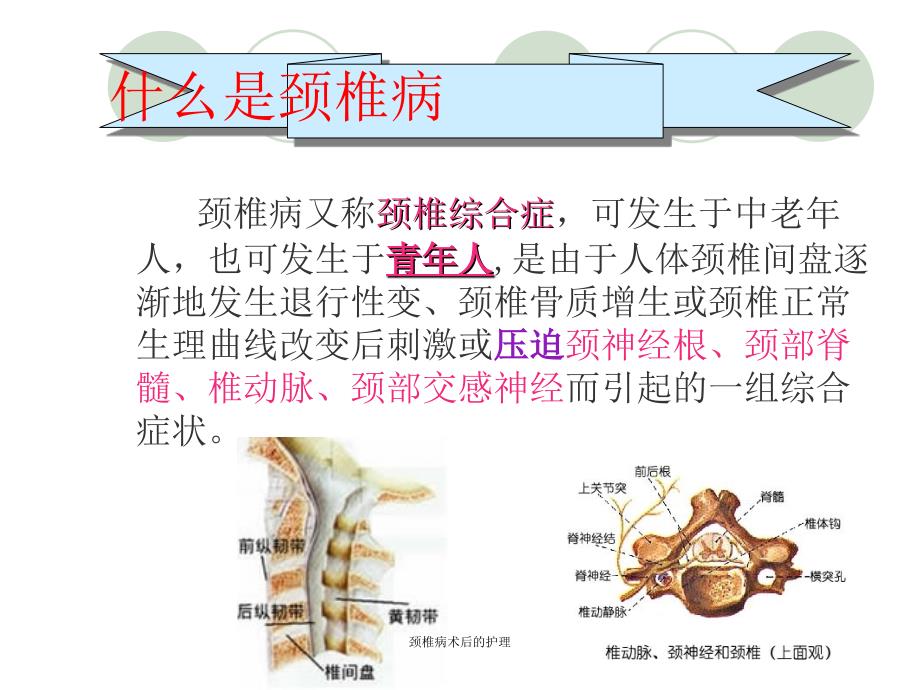 颈椎病术后的护理_第2页