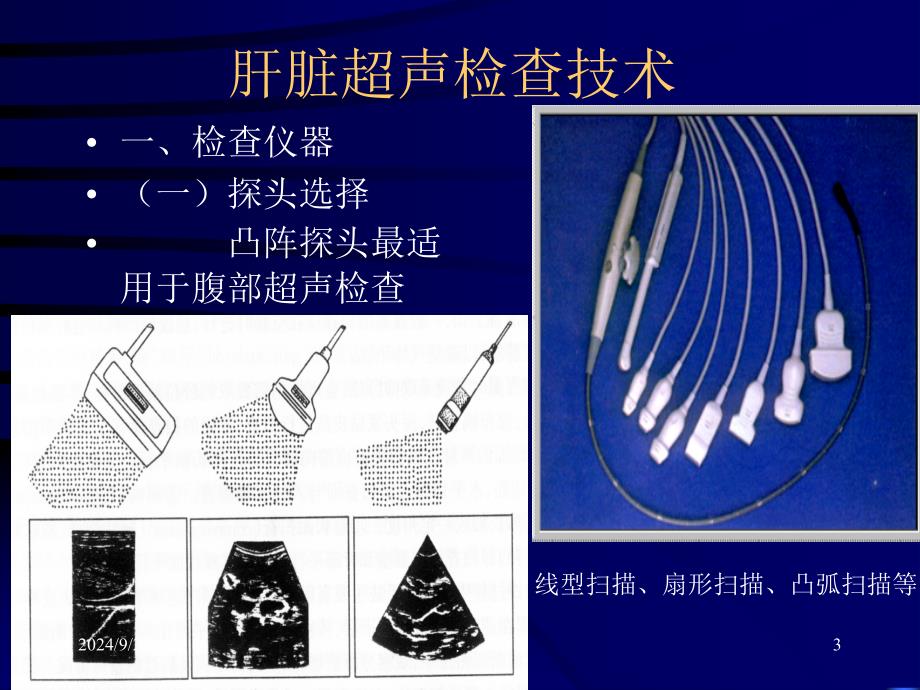 肝脏正常超声声像图ppt演示课件_第3页