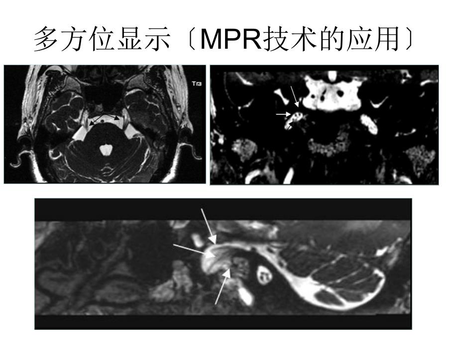 各条颅神经清晰MRI影像3_第4页