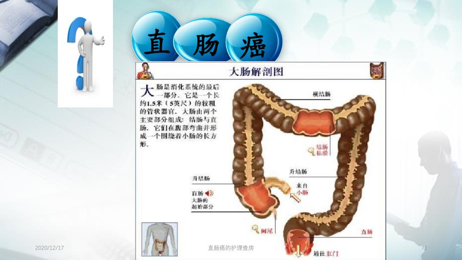 直肠癌的护理查房精选PPT干货_第3页