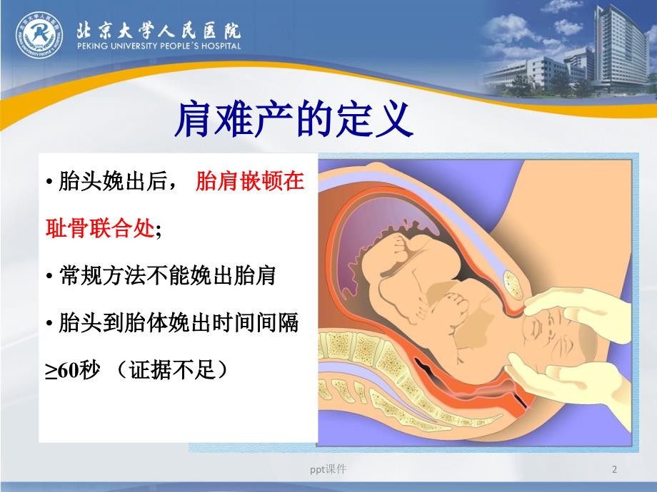 肩难产的识别和处理课件_第2页