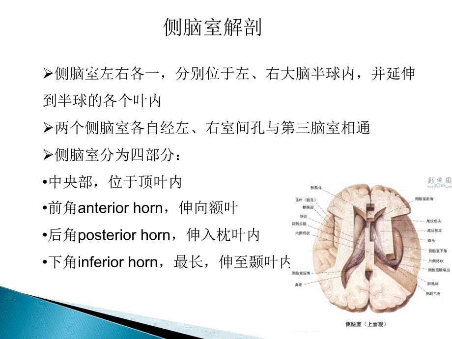 侧脑室肿瘤的诊断与鉴别_第3页