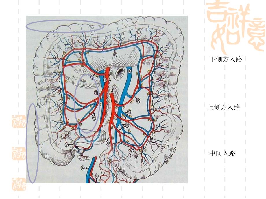 腹腔镜结肠切除术的入路问题_第3页