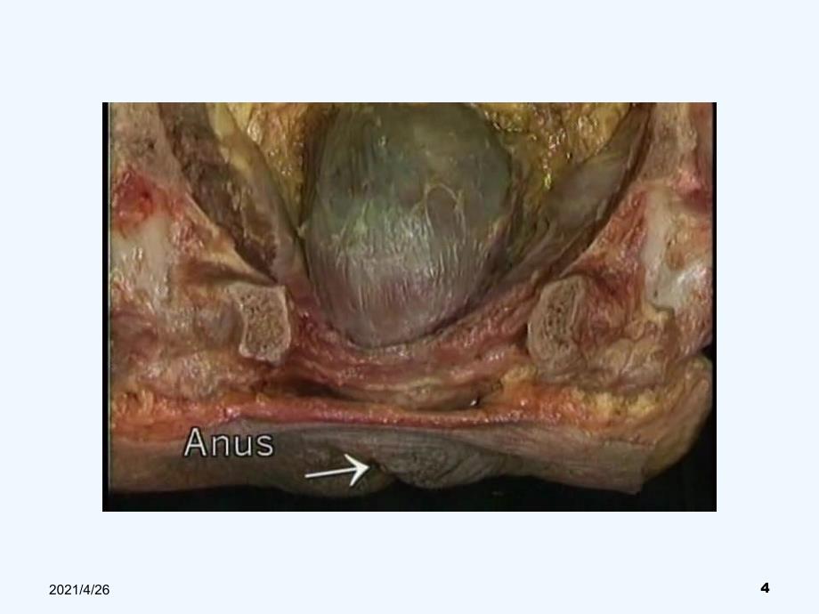 直肠、肛门检查_第4页