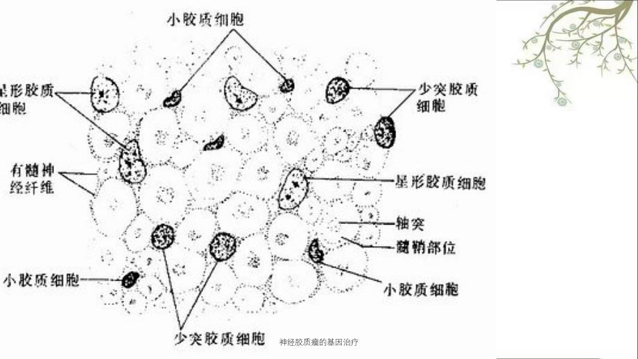 神经胶质瘤的基因治疗课件_第4页