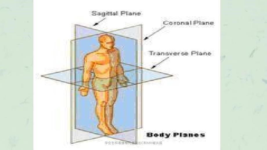 学会怎样看腰椎间盘突出C和MRI磁共振课件_第5页