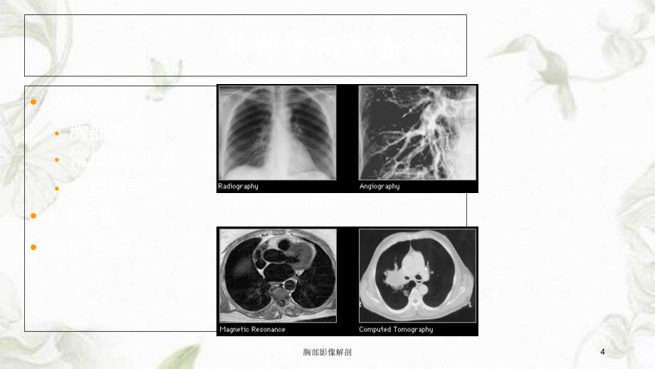 胸部影像解剖课件_第4页