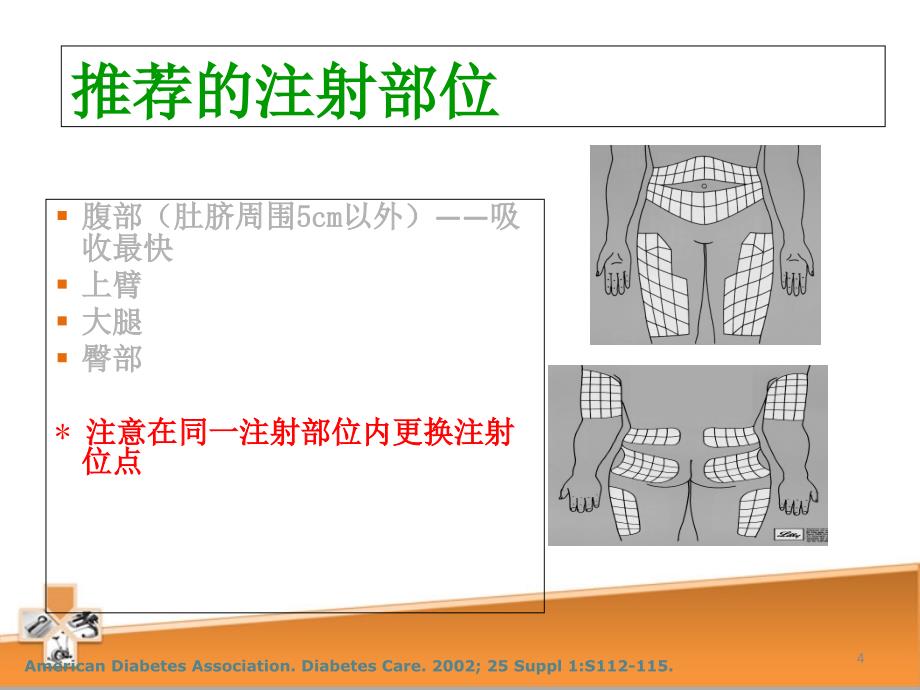 胰岛素注射误区PPT文档资料_第4页