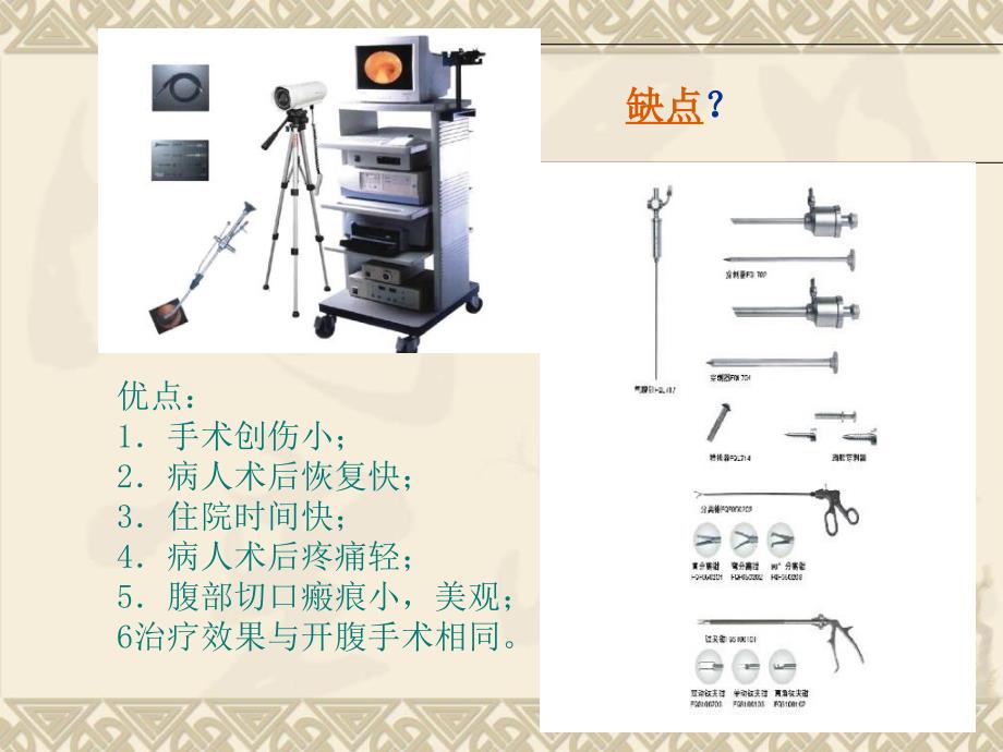 孔腹腔镜下胆囊切除术_第4页