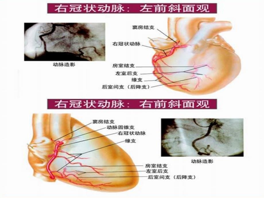 冠状动脉CTA后处技术_第5页