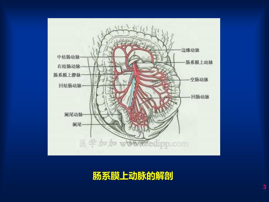 【医学课件大全】肠系膜上动脉狭窄的腔内治疗 (44p)_第3页