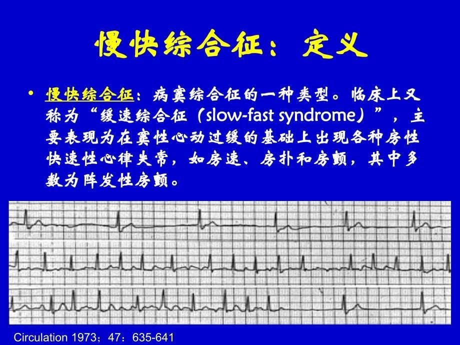 慢快综合征vs快慢综合征治疗策略选择ppt课件_第5页