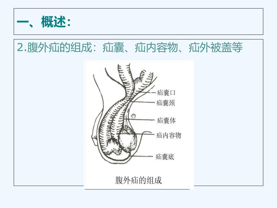 腹外疝医学课件_第4页