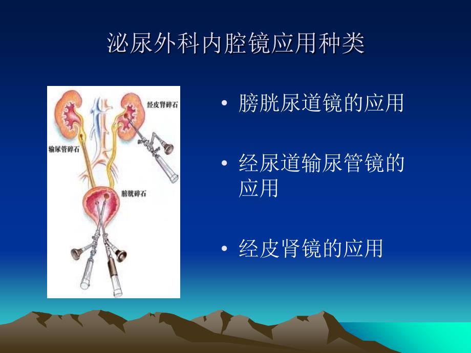 内镜在泌尿外科的应用_第3页