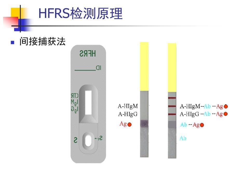 厦门波生肾综合征出血热抗体快速检测试剂_第5页