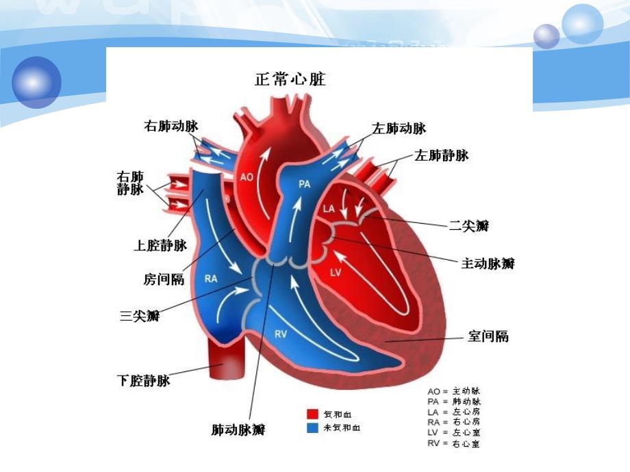 主动脉疾病手术简介.ppt_第4页