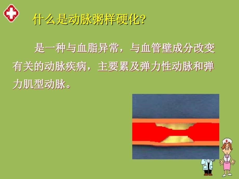 冠心病介入治疗护理查房ppt_第5页