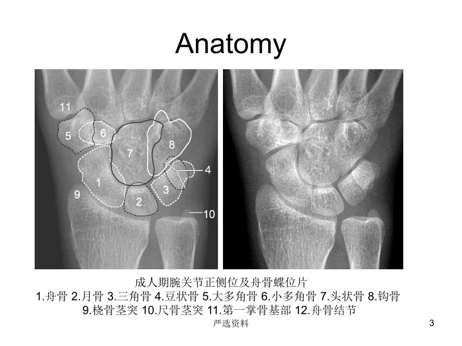 腕关节-X线解剖（行业荟萃）_第3页