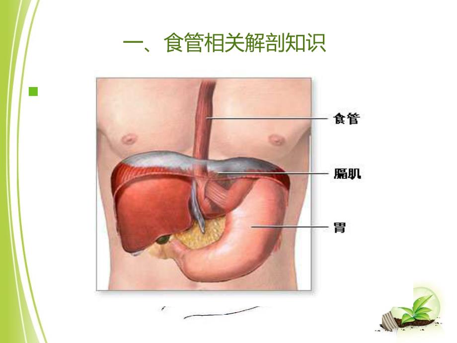 食管癌手术配合_第3页