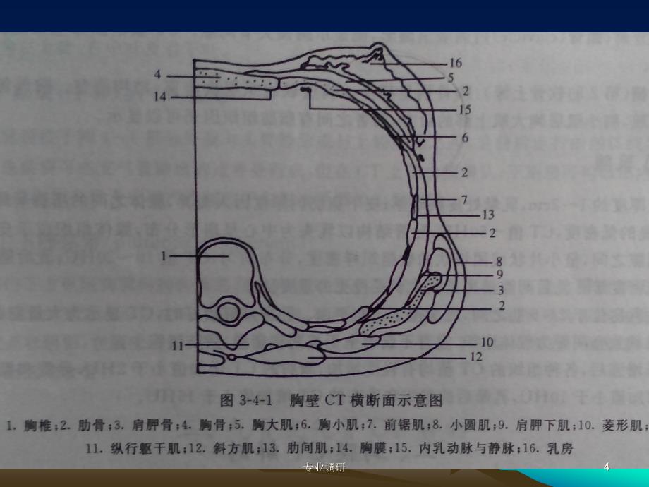 胸部CT解剖严选材料_第4页