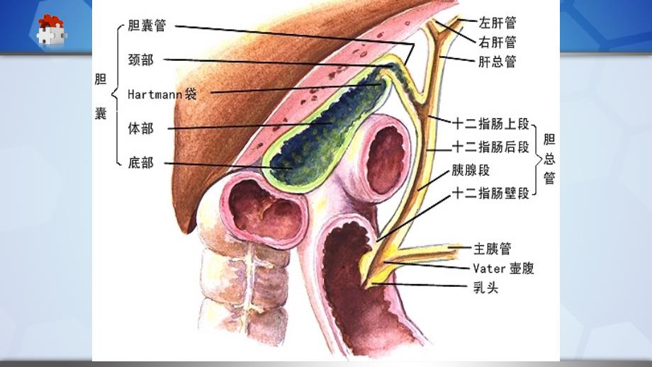 腹腔镜胆总管切开取石,T管引流护理查房_第4页