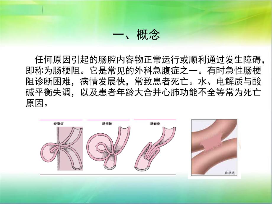 肠梗阻护理常规.ppt_第2页