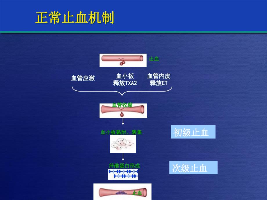 重症患者的出凝血障碍与治疗对策_第3页