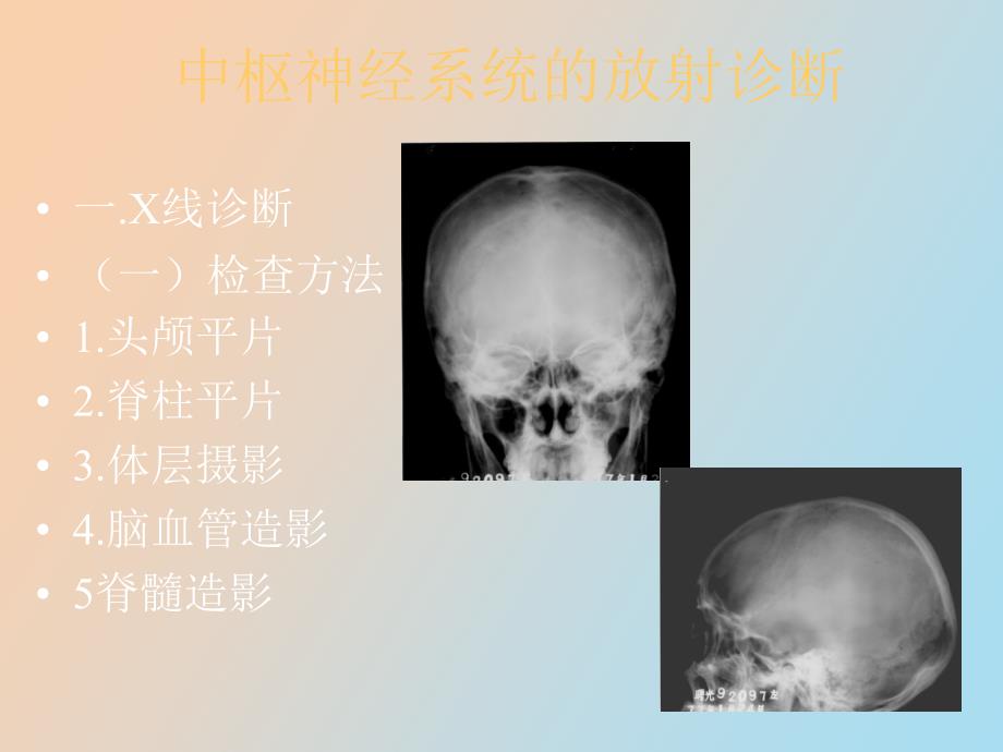 影像诊断神经系统_第1页