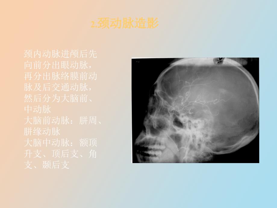 影像诊断神经系统_第3页