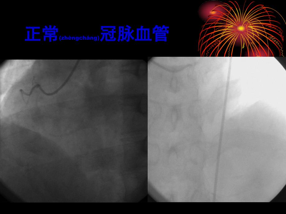 强化血糖控制课件_第3页