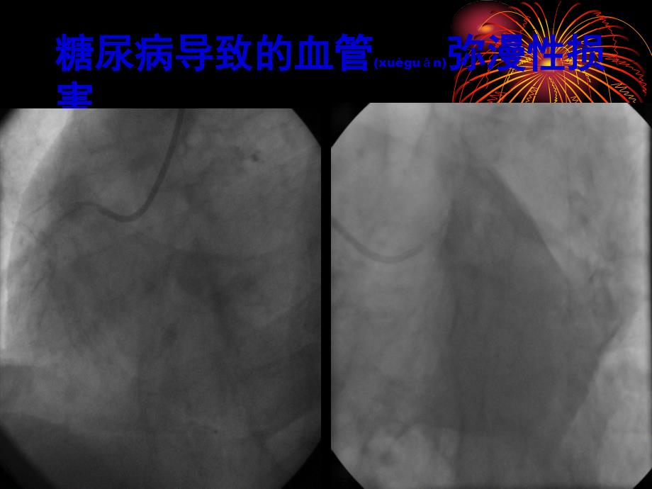 强化血糖控制课件_第4页