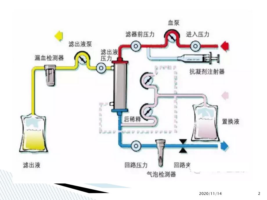 血液透析护理操作过程中风险管理课件_第2页