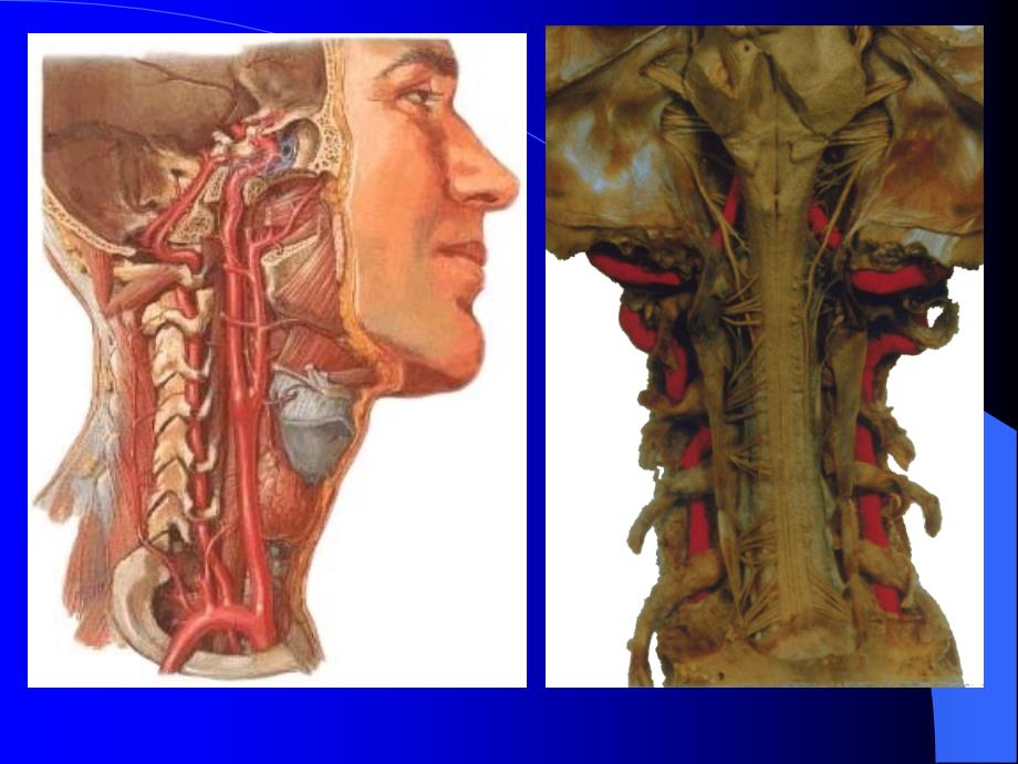 断层解剖脑血管2课件_第2页