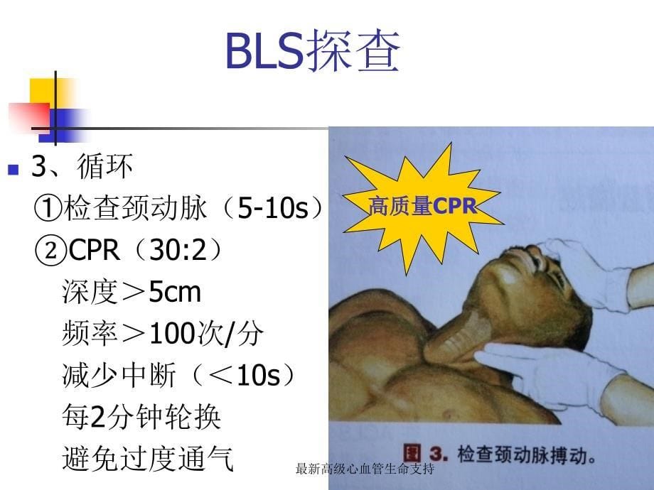 最新高级心血管生命支持_第5页