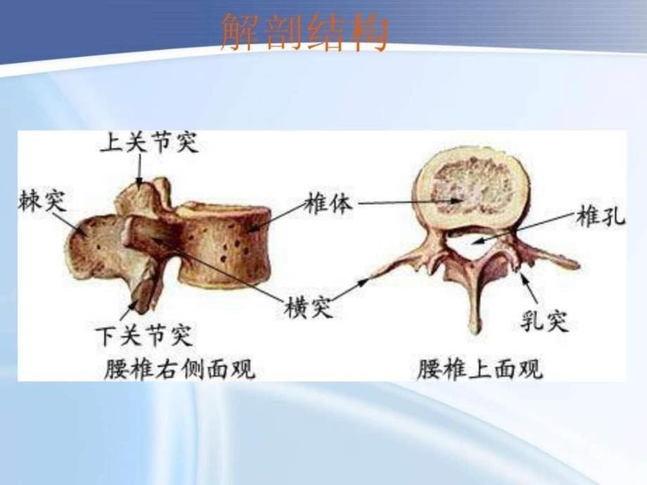 腰椎骨折护理查房.ppt_第5页