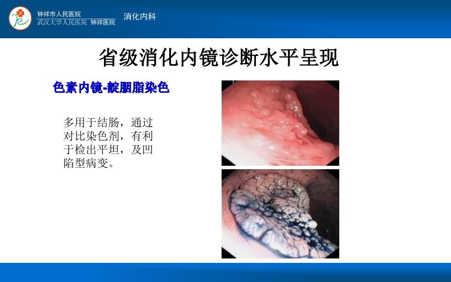 县级医院消化内镜发展中的困惑与思考.ppt_第3页