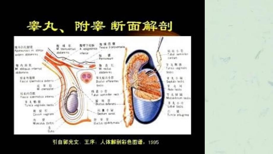 专题讲座睾丸的超声诊断彩色多谱勒（CDFI）上岗考试系列讲义课件_第4页