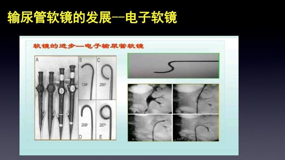 如何做好一台输尿管软镜手术课堂PPT_第5页