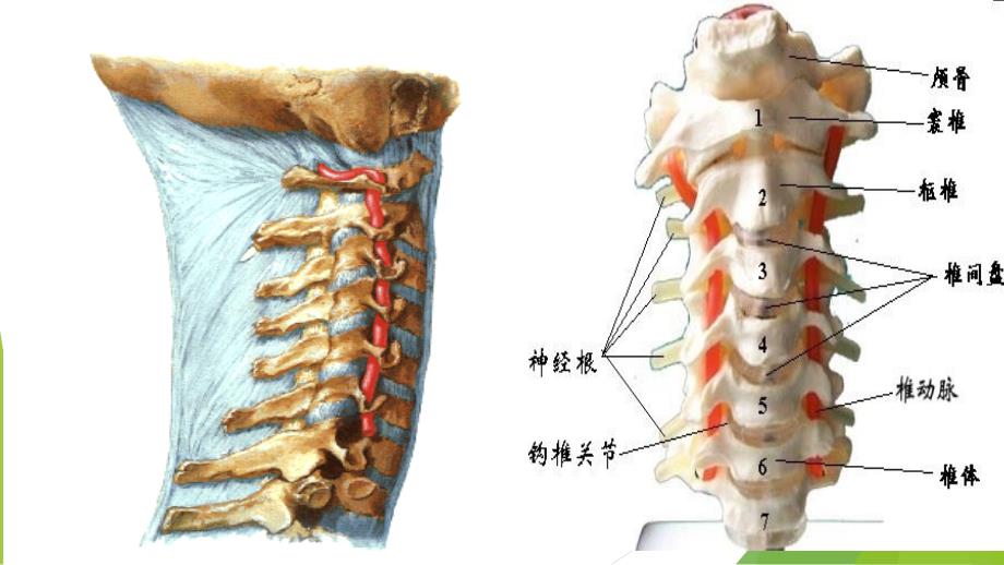 脊髓型颈椎病患者的个案护理查房_第2页