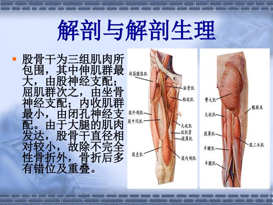 股骨干骨折课件_第4页