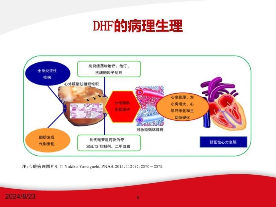 2019舒张性心力衰竭的诊断和治疗PPT参考课件_第5页