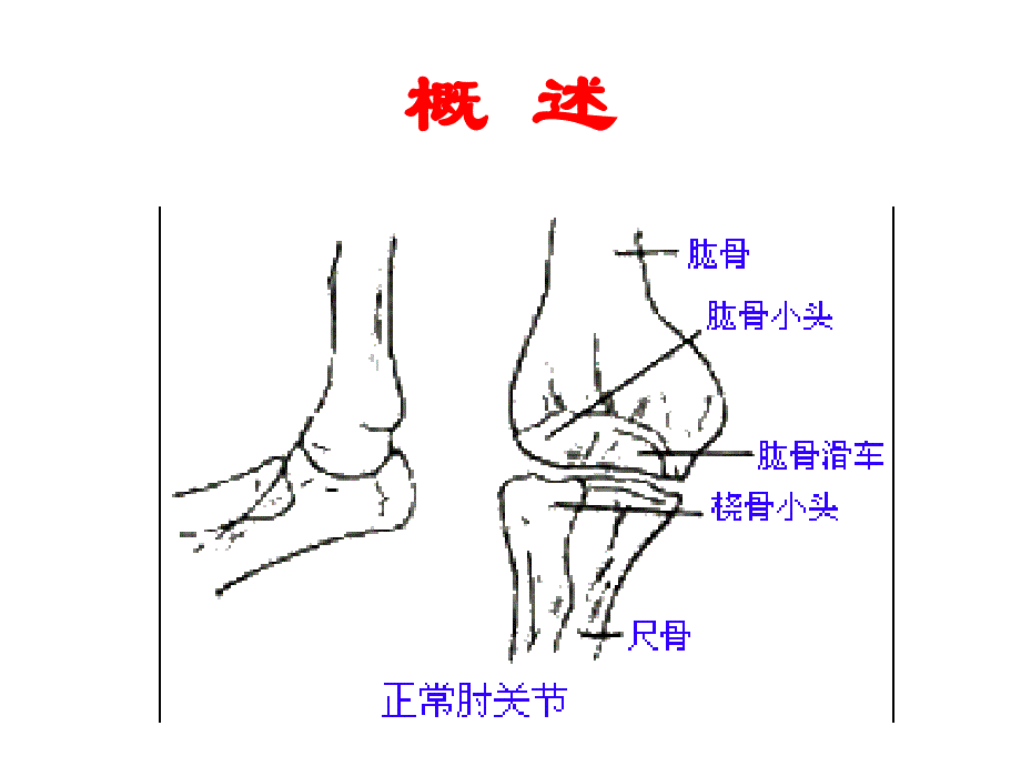 第四节--肘关节脱位课件_第4页