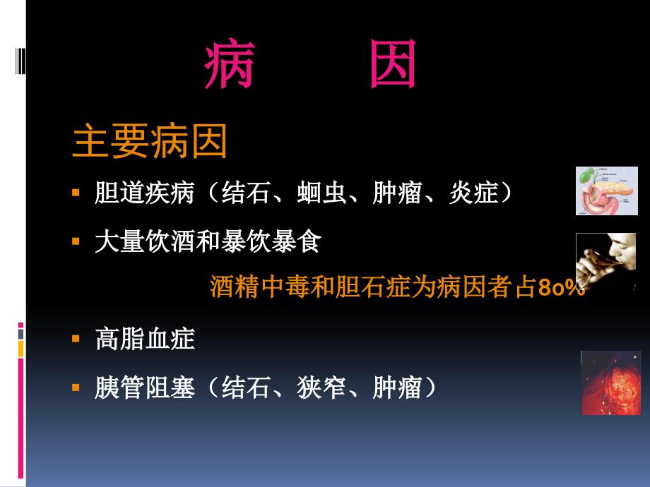 外科医学课件：急性胰腺炎-林庆军2016_第4页