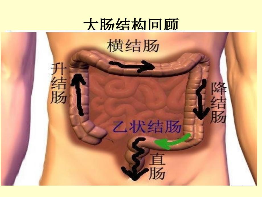 肠癌患者的护理PPT课件02_第3页